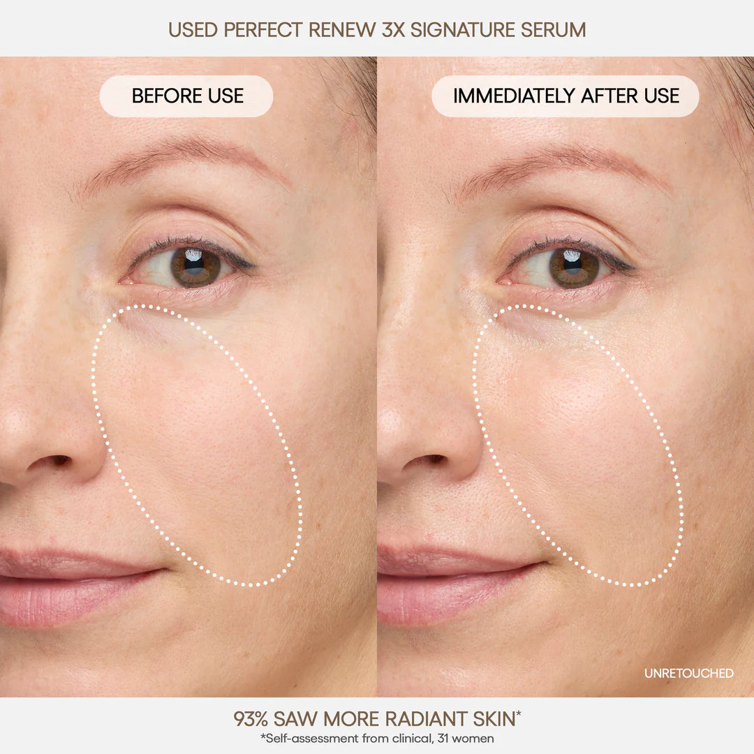 Perfect Renew 3X Signature Serum 40ml