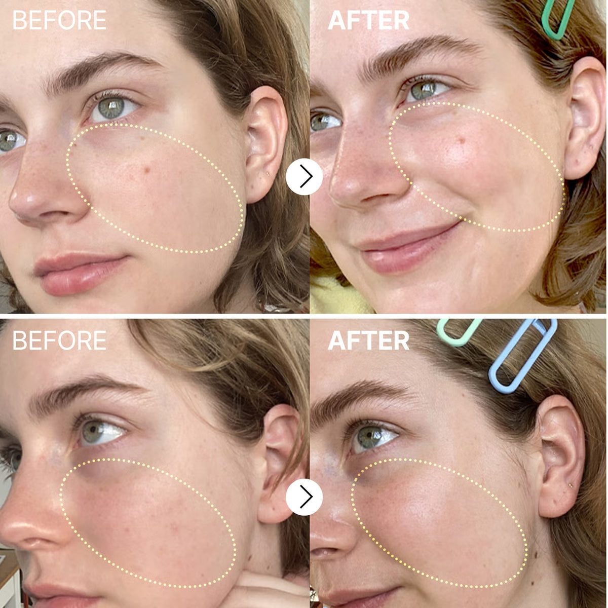 The Vitamin C 23 Serum 20ml