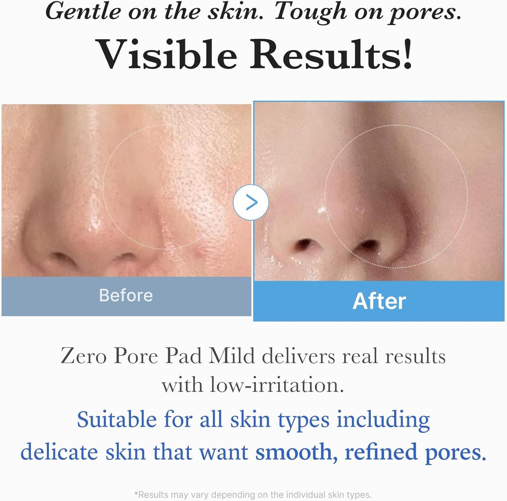 Zero Pore Pad Mild 70pcs